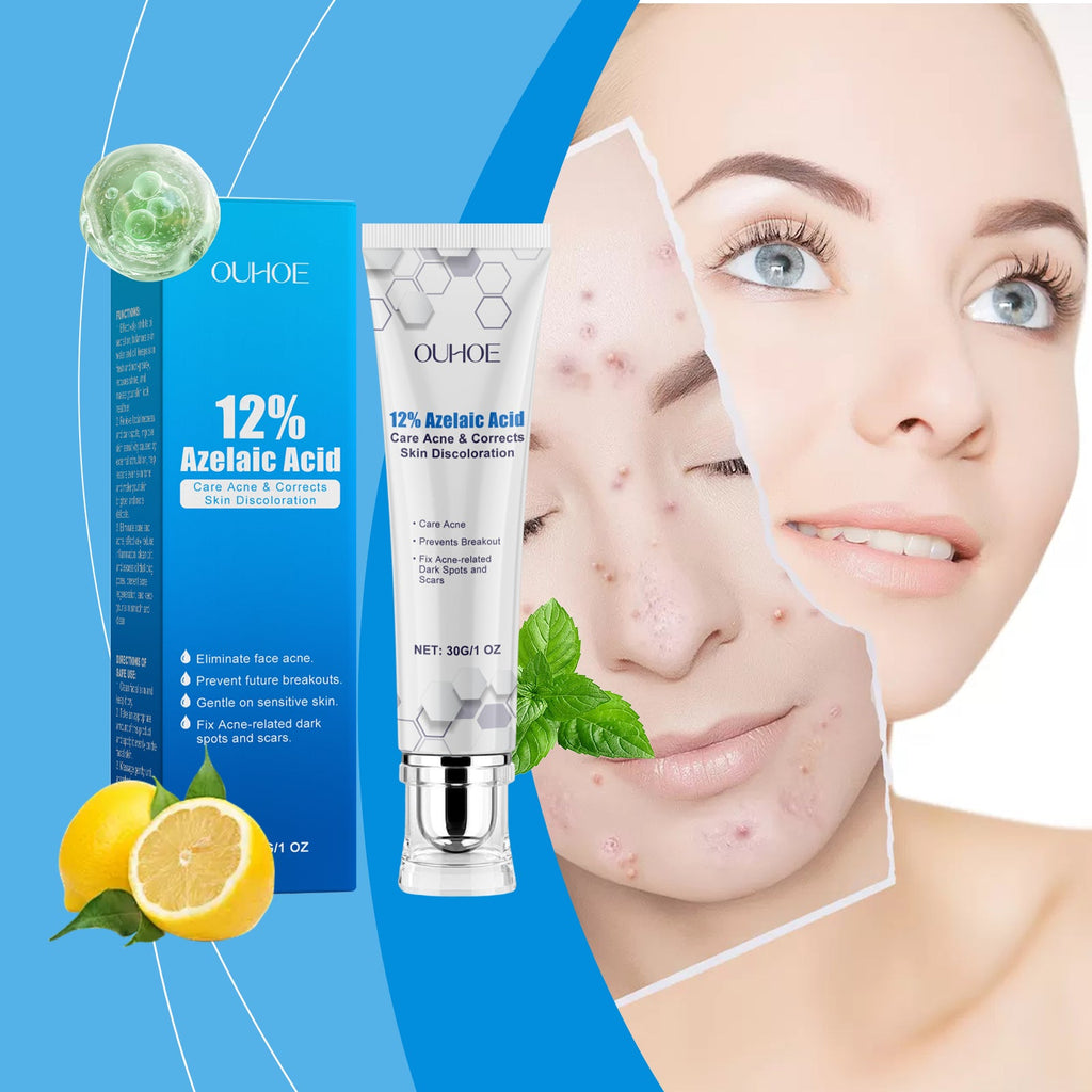 Azelaic Acid Acne Cream Gently Nourishes And Moisturizes Skin And Balances Oil And AcneOuhoe Azelaic Acid Acne Cream Gently Nourishes And Moisturizes Skin And Balances Oil And Acne