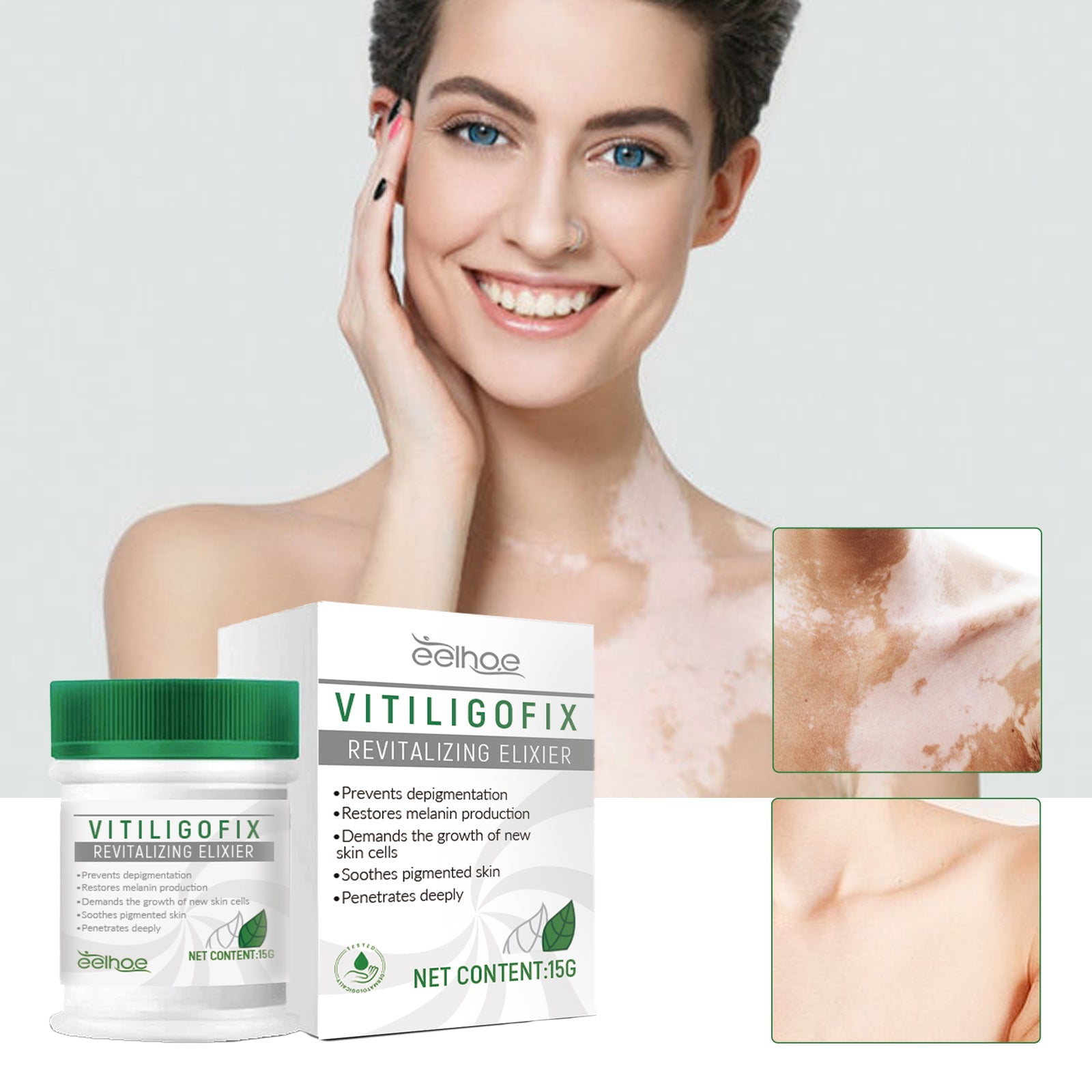 White Spot Repair Cream Skin White Spot Melanin Repair Even Skin Tone Topical Care Cream