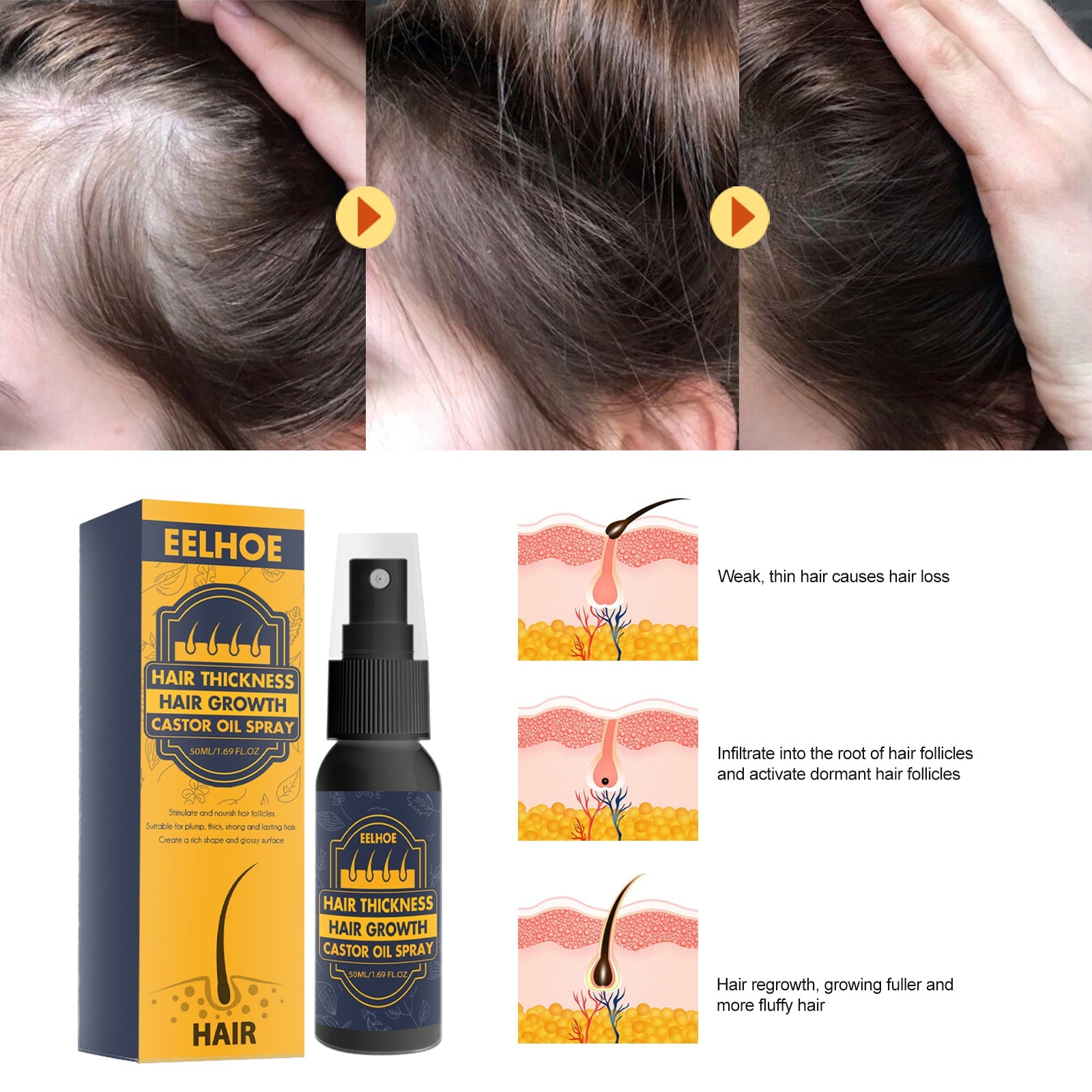 Dense Castor Oil Nutrient Solution, Hair Prevention, Moisturizing Hair Follicles Massage Repair Hair Hair