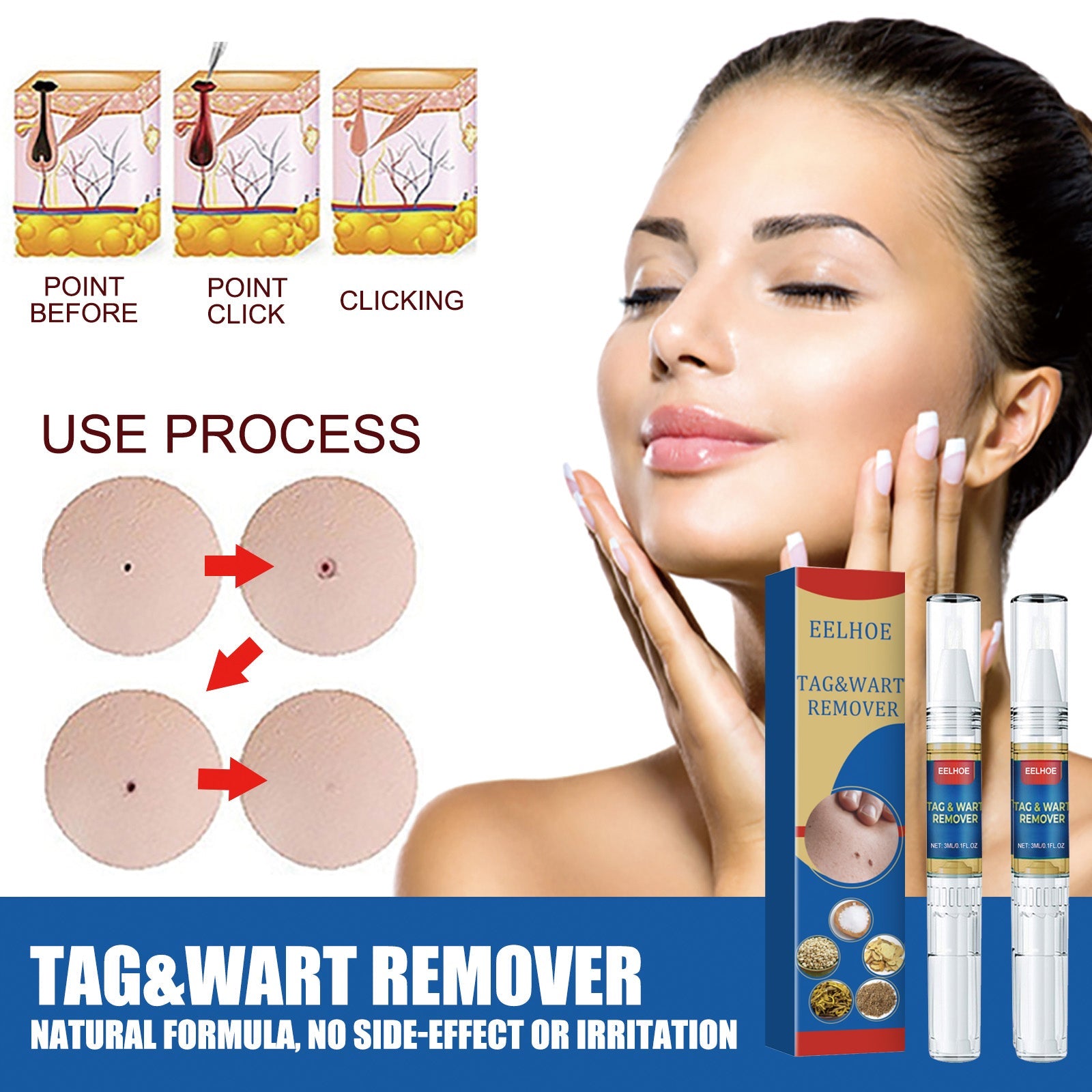 Skin Kayo Pen Gentle Body Tag Remover Cleansing Skin Care Pen