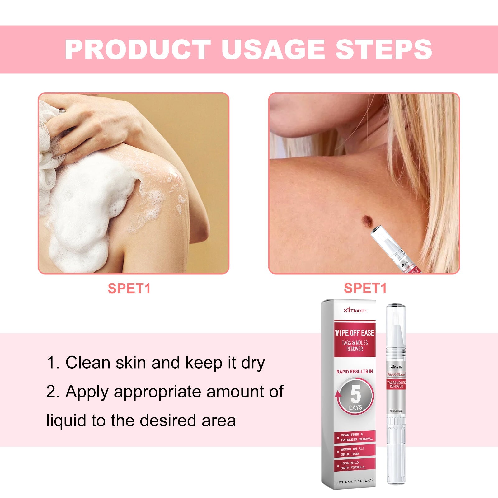 Skin Wart Lotion, Cleanses Skin And Removes Flat Eye Wart Lotion Especially Hand Cocoon