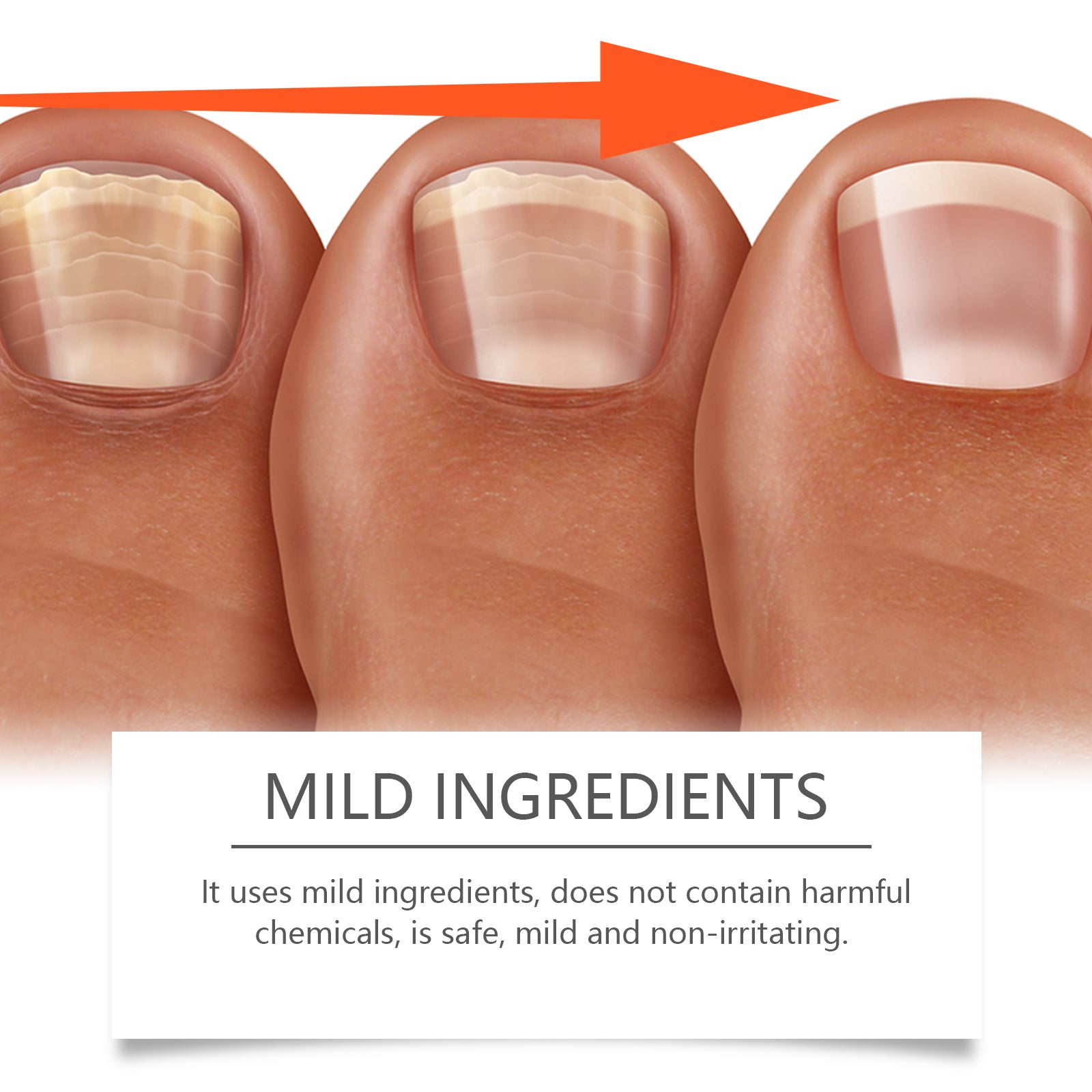 Nail Care Lotion Cleanses And Moisturizes Nails And Nails With A Gentle Conditioning Solution