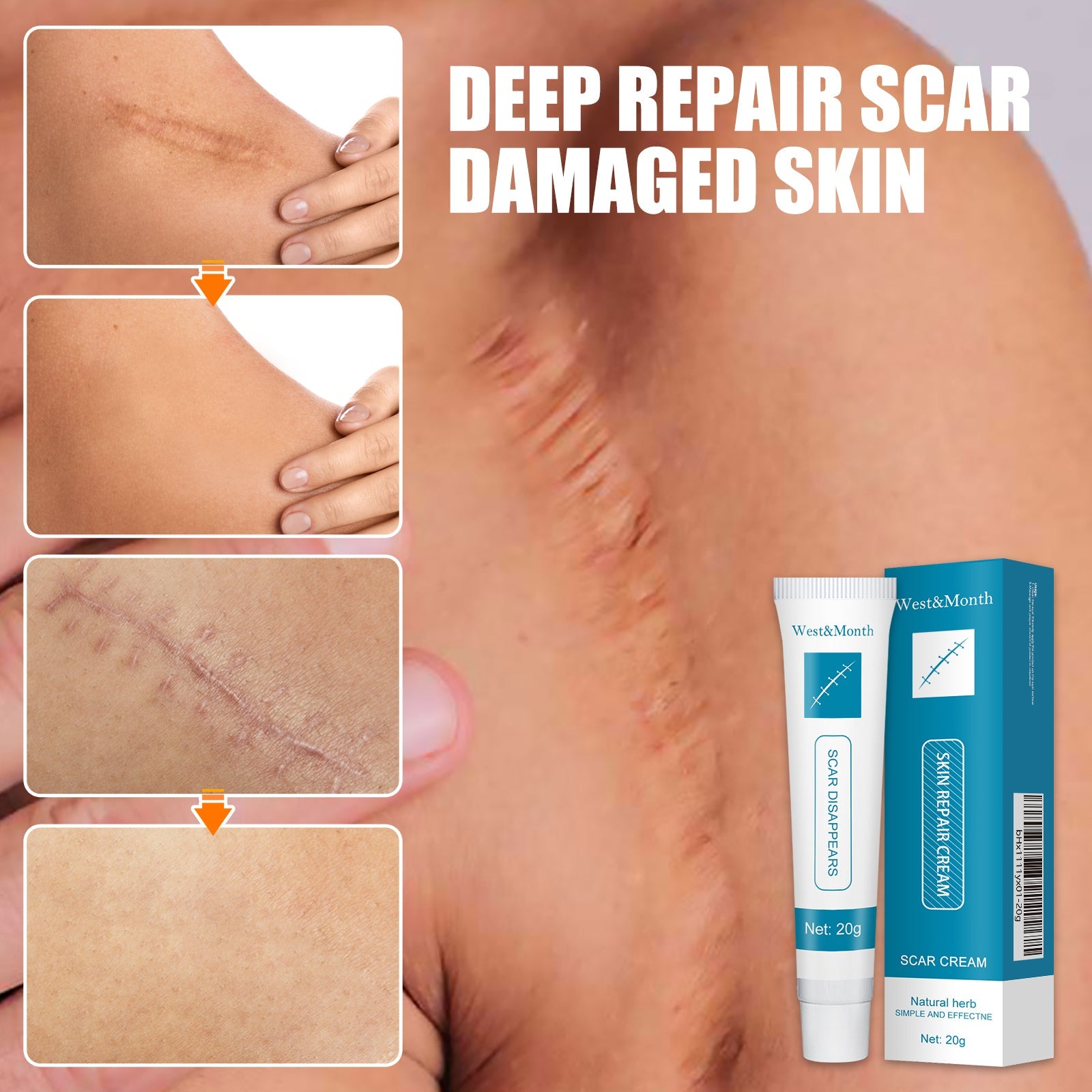 Skin Repair Cream Gentle Moisturizing Hydrating Moisturizing Repair Skin Care Repair Cream