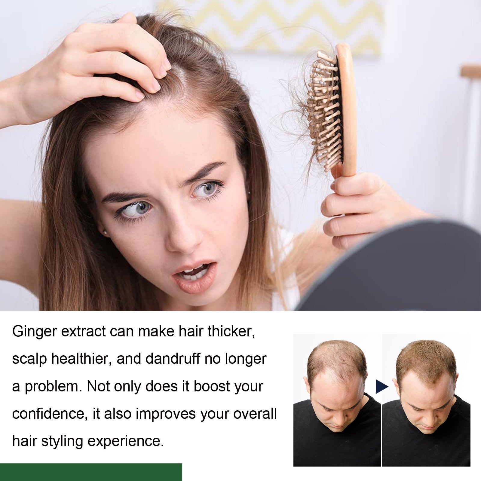 Ginger Hair Care Ball Scalp Care Nourishes Soft, Fluffy, Glossy Hair And Strengthens Hair