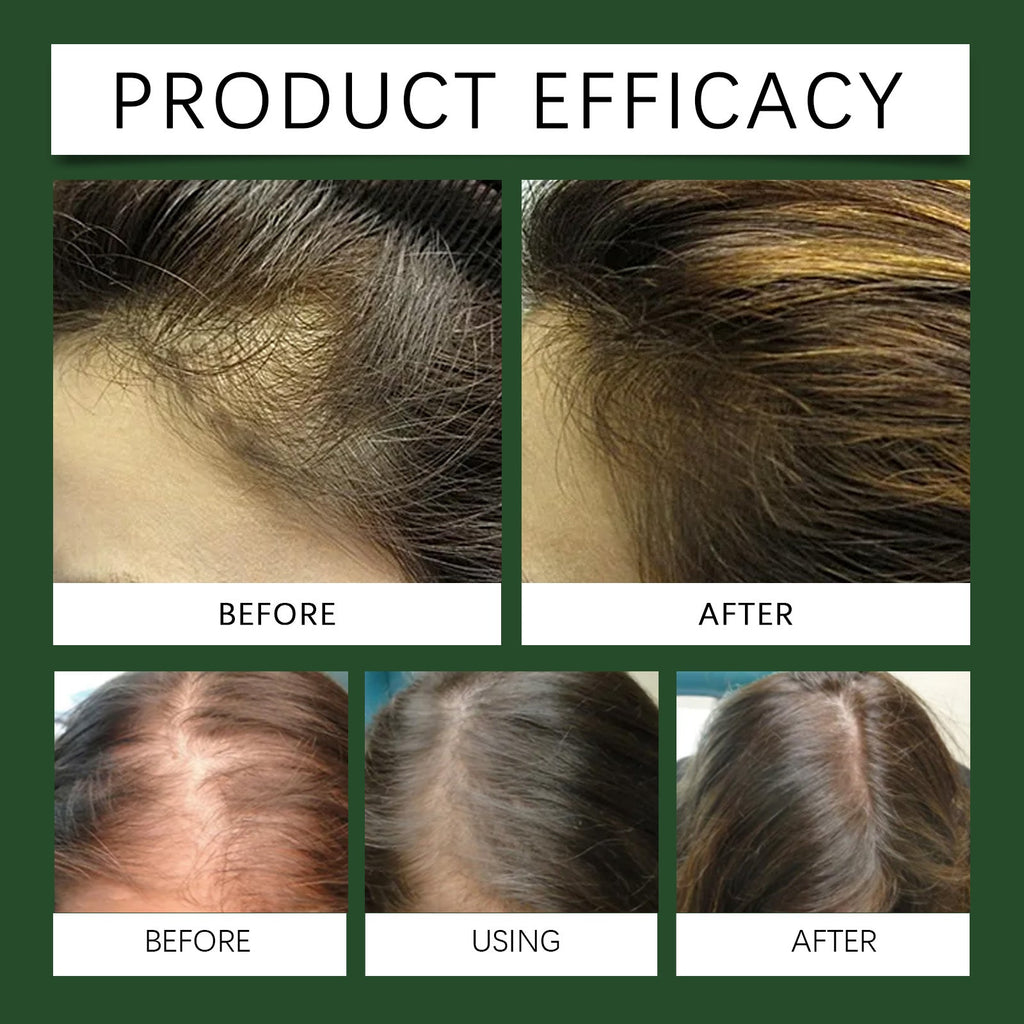 Rosemary Oil For Hair Growth, Promotes Healthy And Nourishing Strong Hair Essential Oil Hair Growth Oil